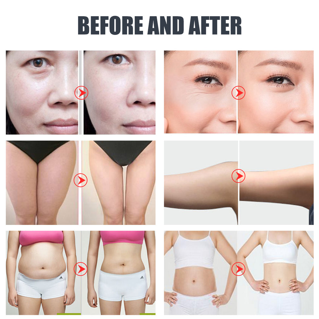 SQ47B Pro | מכשיר קוויטציה 40K לעיצוב הגוף, 6 ב-1 | RF, ואקום, לייזר, EMS